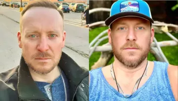 Tyler Duckworth's Cause Of Death, 'The Challenge' Champion Had A Surgery Before His Passing At 44