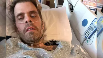 Perez Hilton's Injuries From Bloody Live Are Far Worse Than Cuts, Has Suffered Multiple Broken Bones