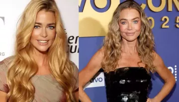 Denise Richards Was Terrified But Chose Facial Surgery, Estranged Husband Leaked Info, Pics Surfaced