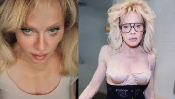'Swelling From Surgeries...', Madonna Boldly Reacted To Being Called 'Unrecognizable' At An Event