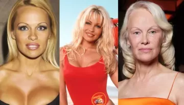 Pamela Anderson's Dramatic Transformation, Had Multiple Breast Implants To Set Beauty Standards