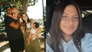 31-Year-Old Influencer Allison Kuch Shows Off 'Botched Nose Job' Which Has 'Fallen To One Side'