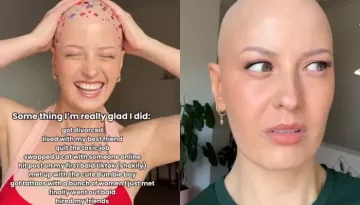 Australian Creator, Holly Who Lost Her Hair At 6, Finally Shows Off Bald Head As She Ditches Wig