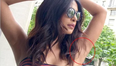  5 Simple Ways To Get Rid Of Armpit Hair   