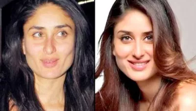  6 Simple And Effective Home Remedies To Fix Under Eye Bags   