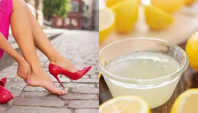  9 Effective Home Remedies To Quickly Get Rid Of Cracked Heels   