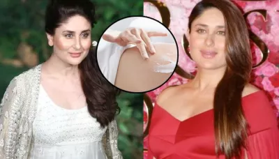  From Stretch Marks To Pigmentation; How To Cure Common Skin Problems After Pregnancy   