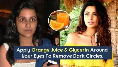 5 Easy And Super-Effective Homemade Remedies To Get Rid Of Dark Circles