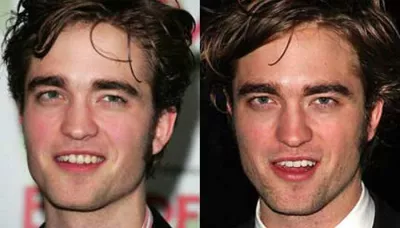 Plastic Surgery For Grooms