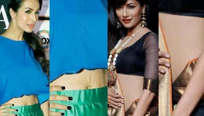  6 Common Foods That Can Help You Get Rid Of Stretch Marks Forever   