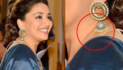 Homemade Remedies That Are Effective In Reducing Neck Wrinkles And Layers Of Fat