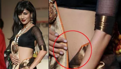  Worried About Stretch Marks? Here's What Dermatologists Say About Treating Stretch Marks   