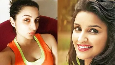  9 Common Lifestyle Habits That Cause Under Eye Dark Circles; It Is Not Just Lack Of Sleep   