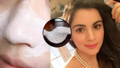  5 Homemade Face Masks To Get Rid Of Blackheads Without Damaging Your Skin   
