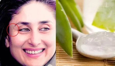  Aloe Vera Homemade Face Packs That Can Cure Any Type Of Skin Problem   