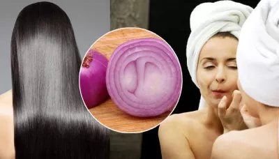  From Reducing Premature Skin Ageing To Controlling Dandruff, 9 Benefits Of Raw Onions   
