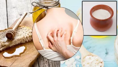  9 Effective Homemade Packs To Get Rid Of Back Acne Overnight   