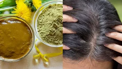  Home Remedies For Grey Hair: How To Stop Premature Greying Of Hair And Prevent Naturally   