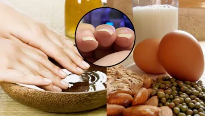  7 Best Ways To Stop Nails From Curling, From Biotin Supplement To Essential Proteins   