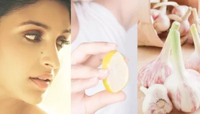  8 Natural Remedies To Remove Moles And Skin Tags At Home   