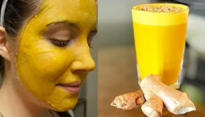  13 Benefits Of Turmeric Milk (Haldi Doodh), From Glowing Skin To Healing Joint Pains   