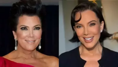 Amid Kris Jenner's 'Real' Nose Comment, Her Before And After Plastic Surgery Look Resurfaces