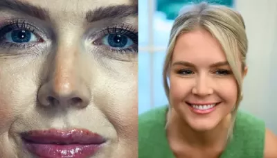 Karoline Leavitt's Before And After Vanity Fair Shoot Pics Made Fans Ask 'Are Those Lip Fillers?'