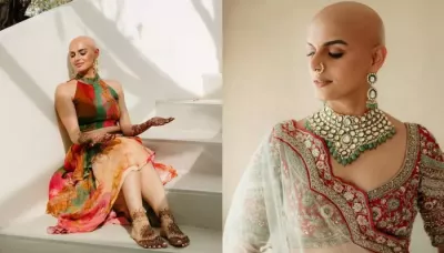 Mehendi Bride Flaunts Her Baldness Bravely, Dons A Beautiful And Vibrant Co-Ord Set And Soft Makeup
