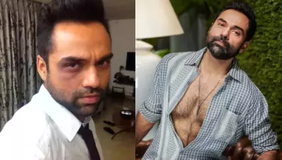 Abhay Deol Once Attended A Red Carpet Event With Black Eye While Exposing The Dark Side Of T-Series