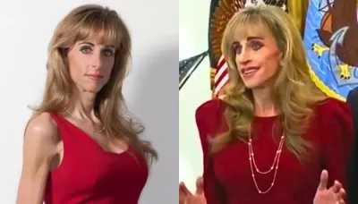  Susan Dell's 'Mar-A-Lago' Face Leaves Internet Stunned, Sparks Debate Over Plastic Surgery   