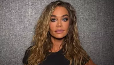 Denise Richards Says Ex-Husband's 'Botched' Facelift Remark Inspired Her To Open Up About Procedure
