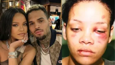  Rihanna Once Became The Poster Child Of Domestic Abuse, Her Bruised Face Surfaced All Over The Media   