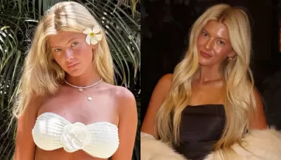  21-Yr-Old Influencer Spent USD 16K On Cosmetic Surgeries, From Lip Fillers To Breast Implants   