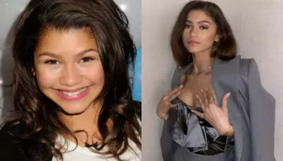 Zendaya's Before-And-After Photos, From Her Disney Debut In 2010 To Changed Appearance In 2026