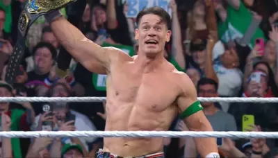  John Cena Says Hair Transplant 'Totally Changed' His Life, Recalls His Surgery Was '8 Hours Long..'   