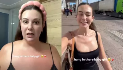  UK Influencer Loses 80 Kg After Weight Loss Surgery, Explains Why She Underwent The Procedure   
