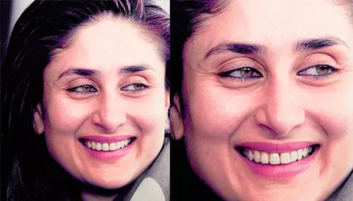 10 Most Effective Home Remedies To Get Rid Of Wrinkles And Look Younger Always