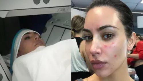 Kim Kardashian's Brain Aneurysm, Inside Her Many Health Struggles With Psoriasis, Arthritis And More