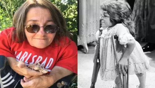 Melanie Watson Wasn't Comfortable Using Crutches On Diff'rent Strokes, 'I Was Carried Everywhere'