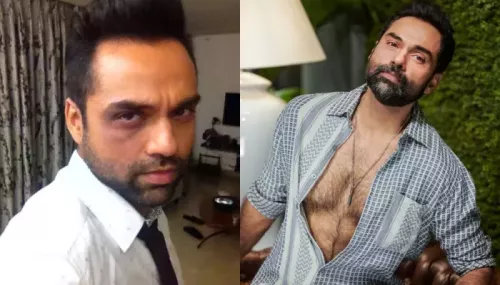 Abhay Deol Once Attended A Red Carpet Event With Black Eye While Exposing The Dark Side Of T-Series