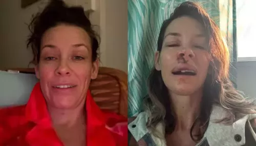 What Caused Evangeline Lilly's Traumatic Brain Damage After Hawaii Fall? 'I Smashed My...'