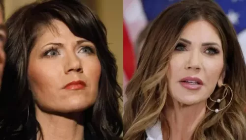 Kristi Noem's Throwback Photos Assert Plastic Surgery Claims, Her Transformation Is Hard To Miss