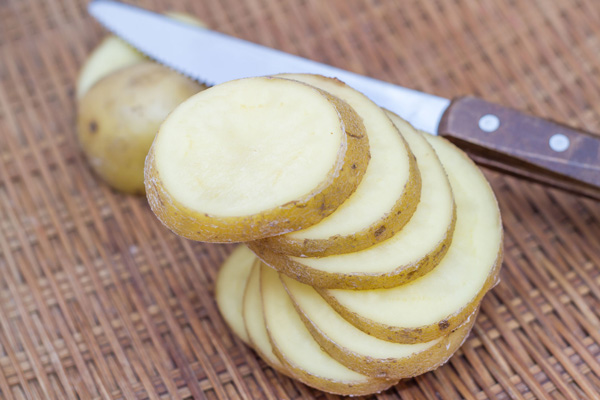 commom foods with health benefits- potatoes