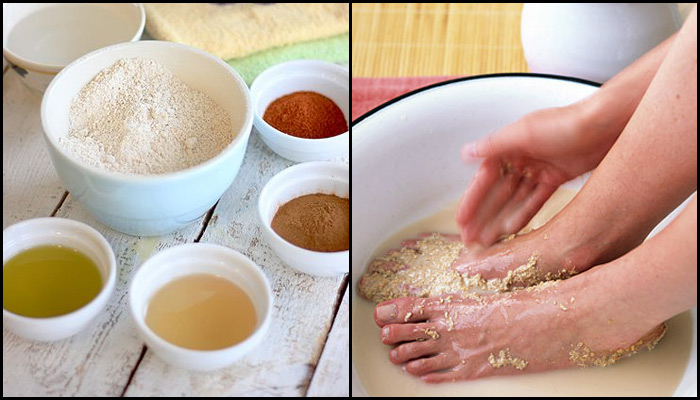 tips to keep feet clean during monsoon 5 -  bollywoodshaadis
