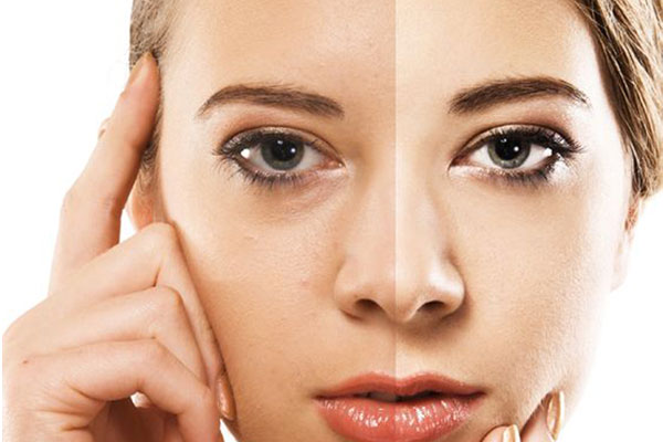 gooseberry amla beauty benefits