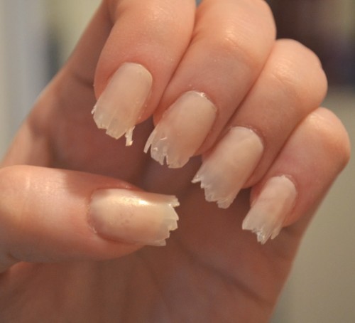 cracked nails