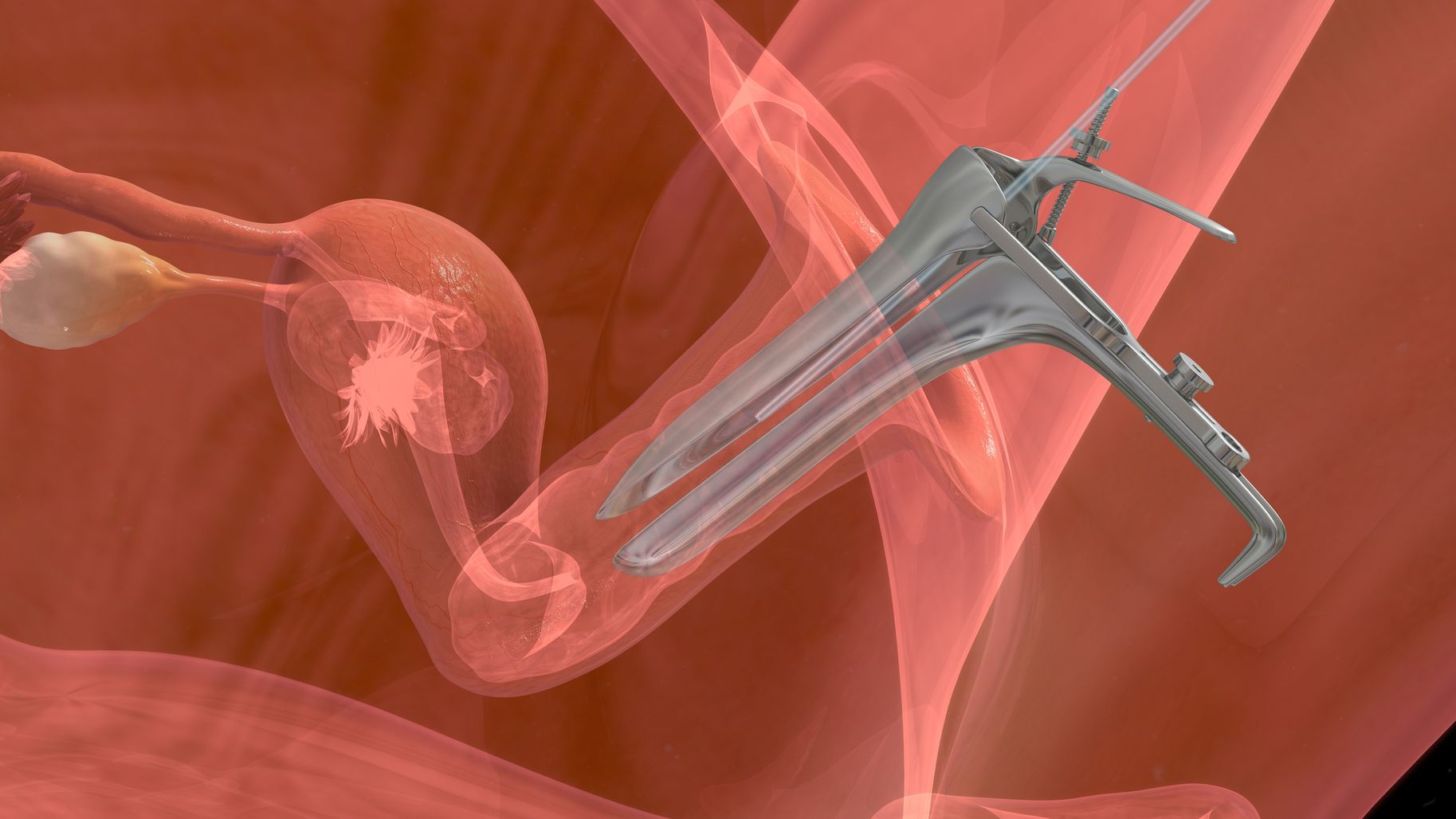 процедура введения спермы в матку фото 22