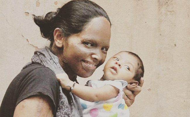 Acid attack survivors love stories