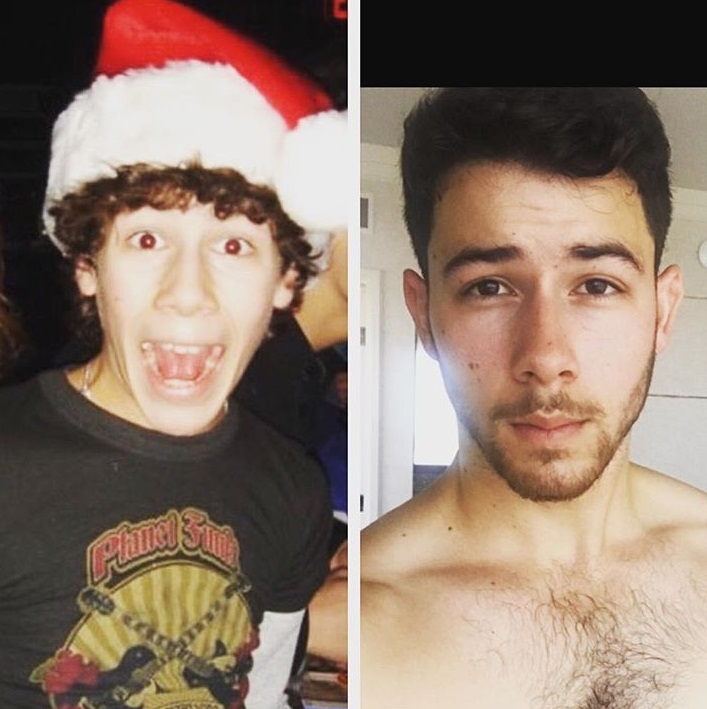 Nick Jonas Shares He Was Diagnosed With Diabetes