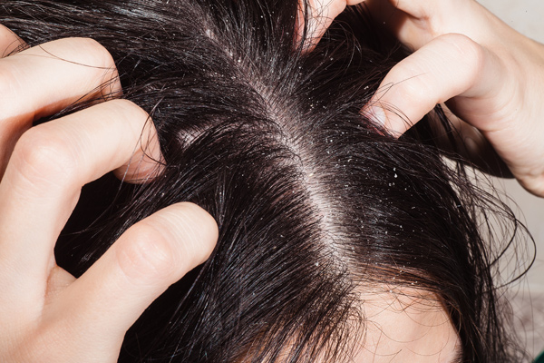 Benefits of Raw Onion